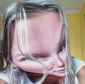 Me and my bells palsy Novocaine face